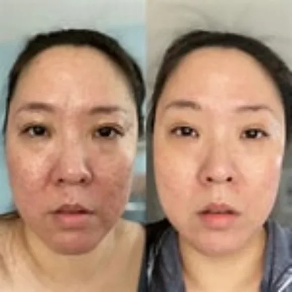 InCellDerm Ritual - Picture 2 of 2